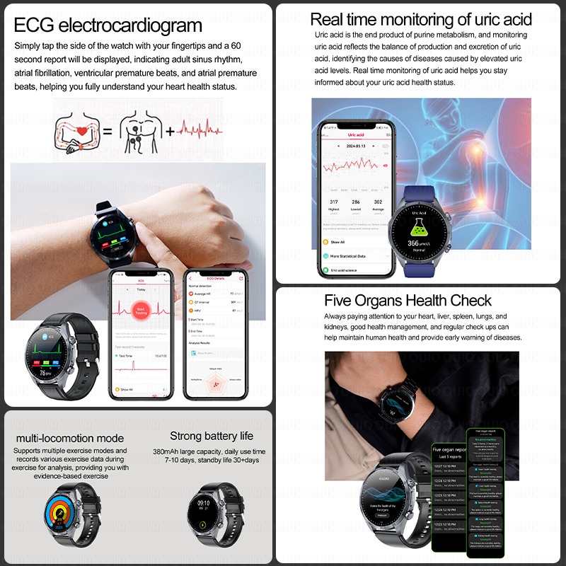 Nowy smartwatch 2026 z ulepszo – Smartwatch Online Watches For Women recenzja i cena